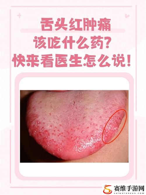 关注“舌头吃小豆豆时的口腔健康”：保持口腔清洁的关键